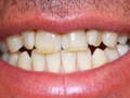 Cosmetic dentistry Arlington Height IL